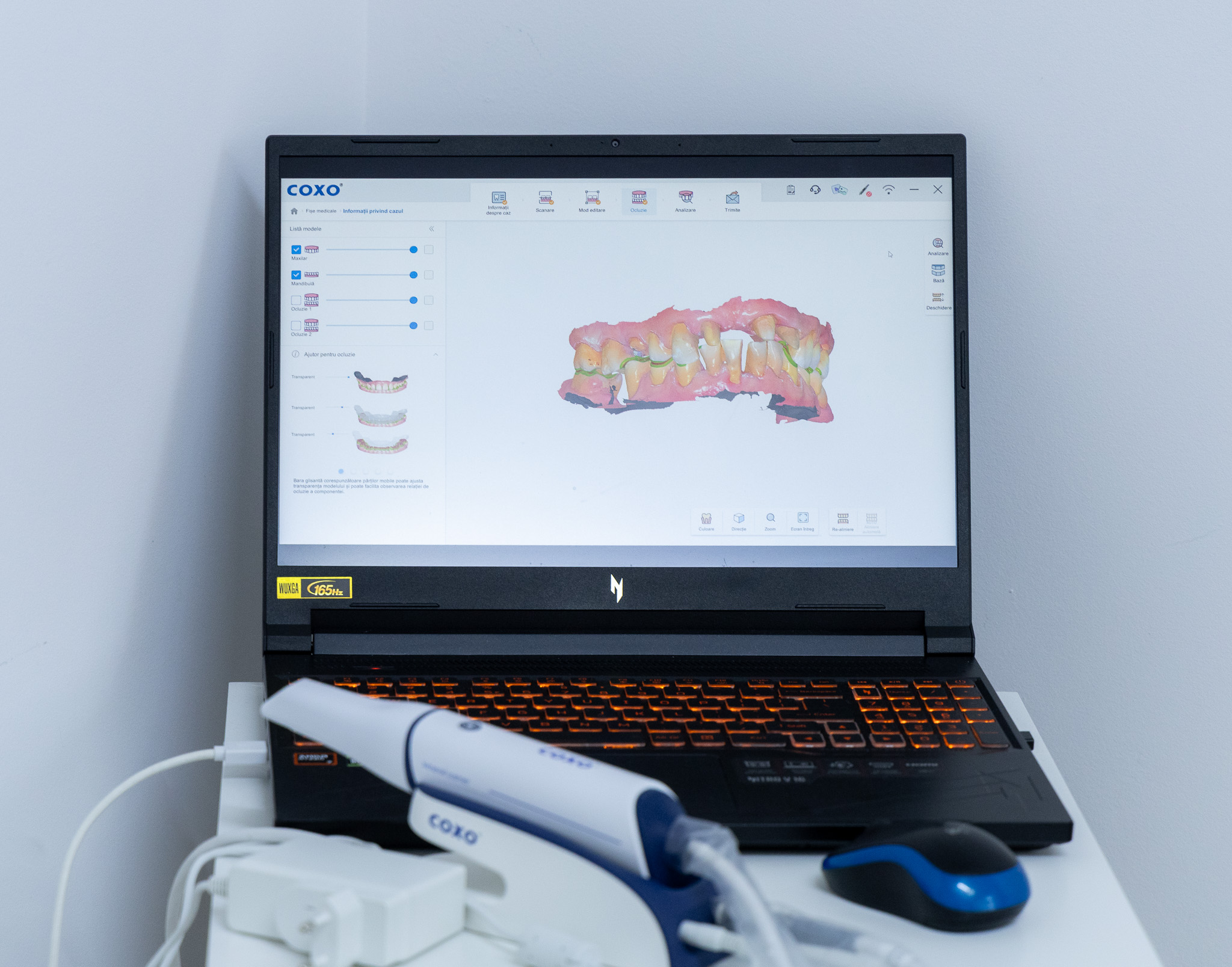 Scanner intraoral Duo Dent