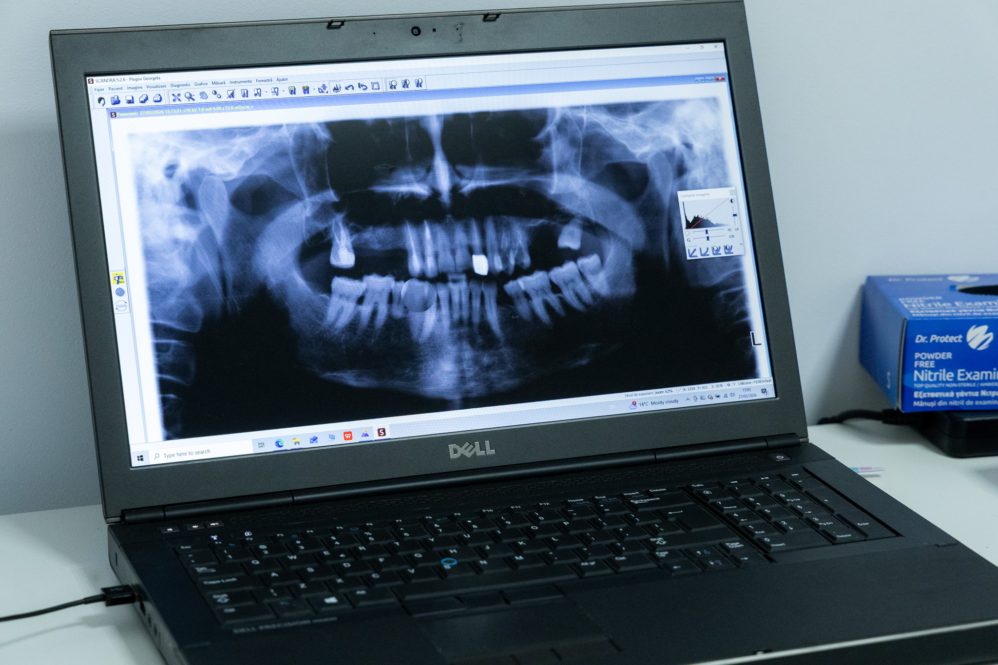 Când se face o radiografie dentară și de ce poate fi utilă